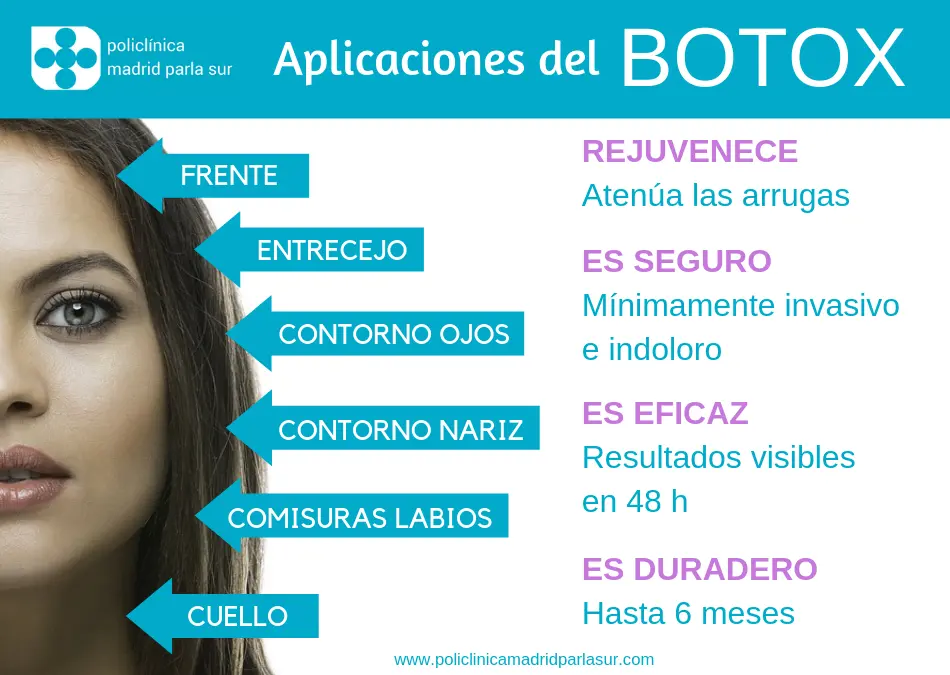 botox aplicación estetica - Cuánto cuesta una aplicación de bótox en la cara