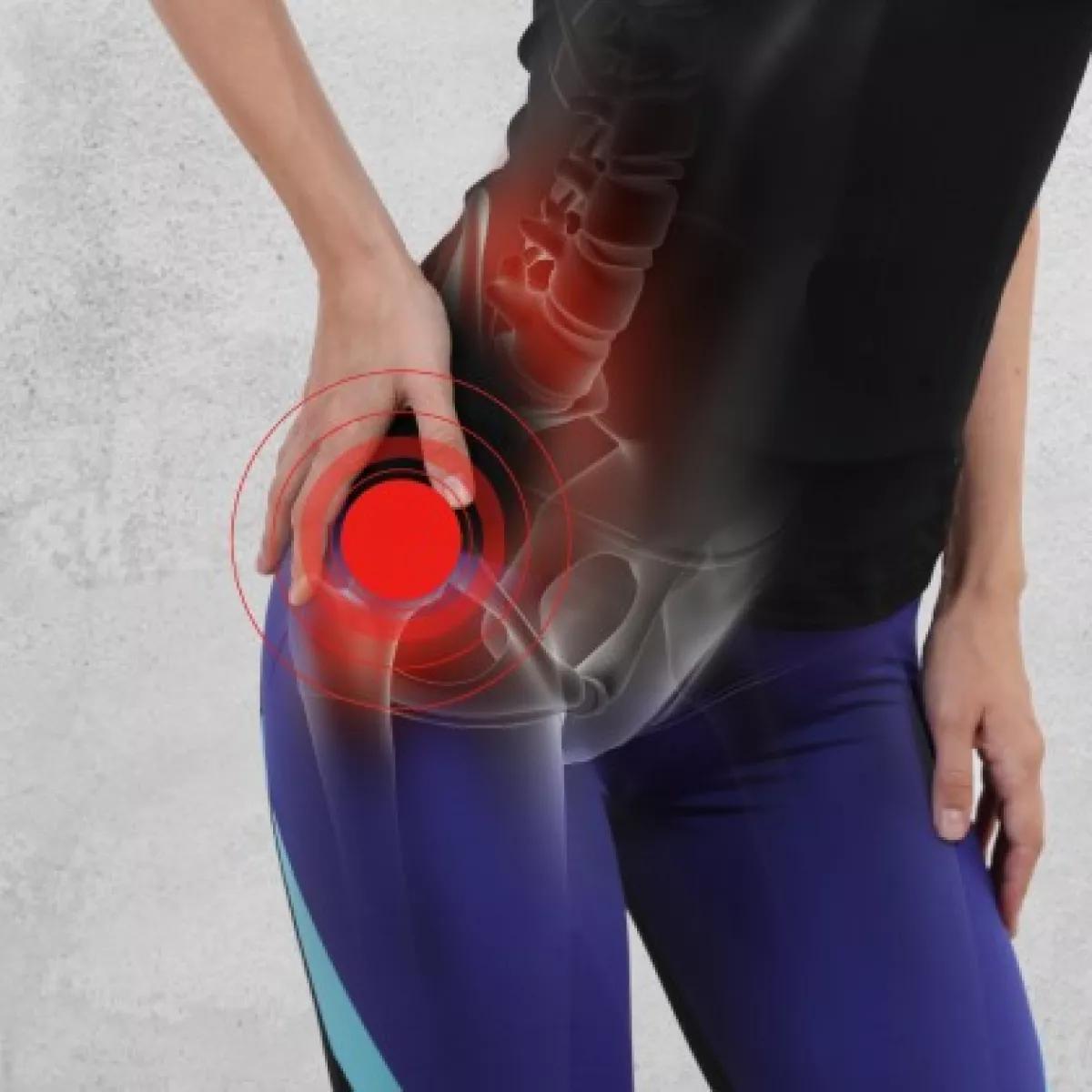medicina natural para dolor de cadera - Qué hacer para aliviar el dolor de cadera